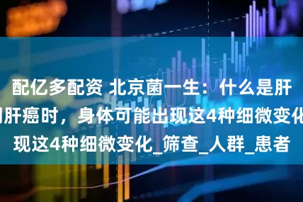 配亿多配资 北京菌一生：什么是肝癌？提醒：早期肝癌时，身体可能出现这4种细微变化_筛查_人群_患者